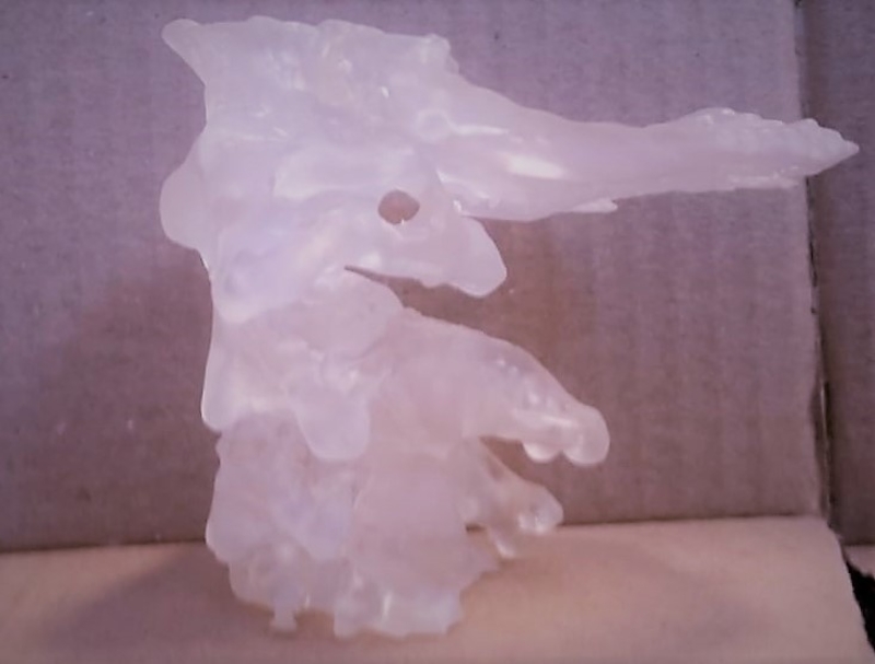 Cervical spine with a type 2 odontoid fracture