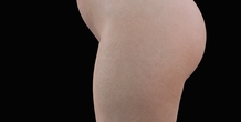 Image 210910