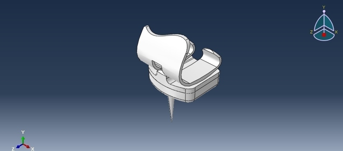 human knee implant 3D Print 221782