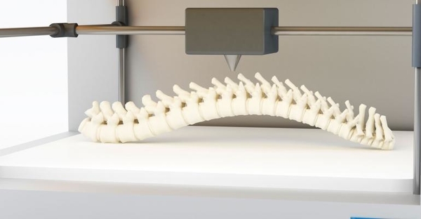 Revolutionizing The Medical Industry With 3D Printing