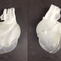 Revolutionizing The Medical Industry With 3D Printing - Thumbnail 3