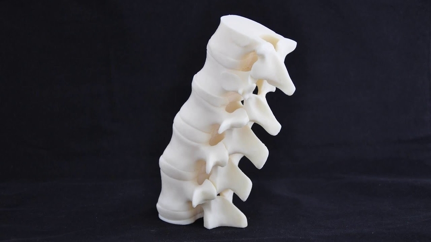 Revolutionizing The Medical Industry With 3D Printing 3D Print 233925