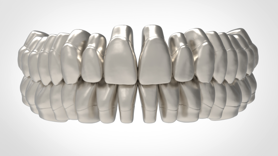 Dental Anatomy Library with Thimble Crowns - Azure  3D Print 241168