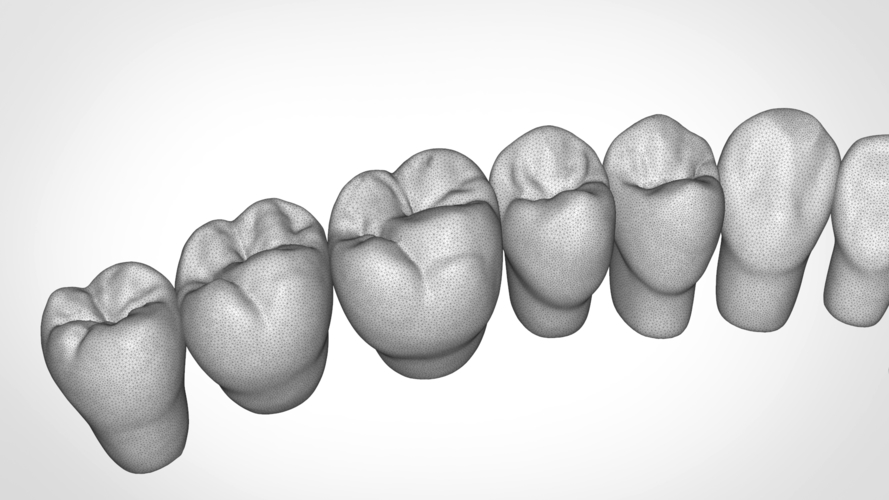 Dental Anatomy Library with Thimble Crowns - Azure  3D Print 241181