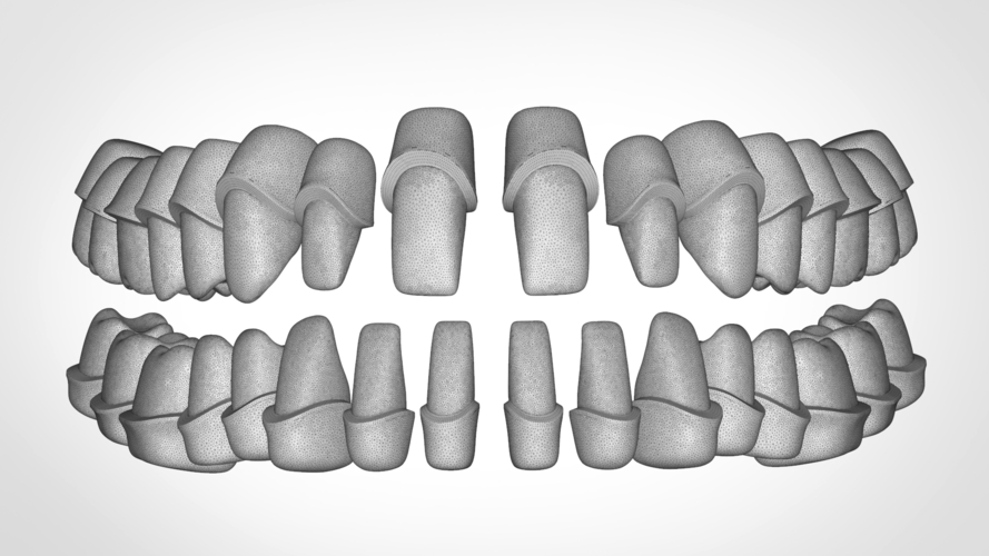 Dental Anatomy Library with Thimble Crowns - Azure  3D Print 241182