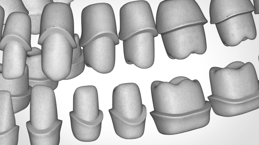 Dental Anatomy Library with Thimble Crowns - Azure  3D Print 241183