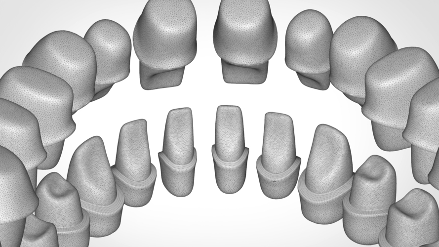 Dental Anatomy Library with Thimble Crowns - Azure  3D Print 241184
