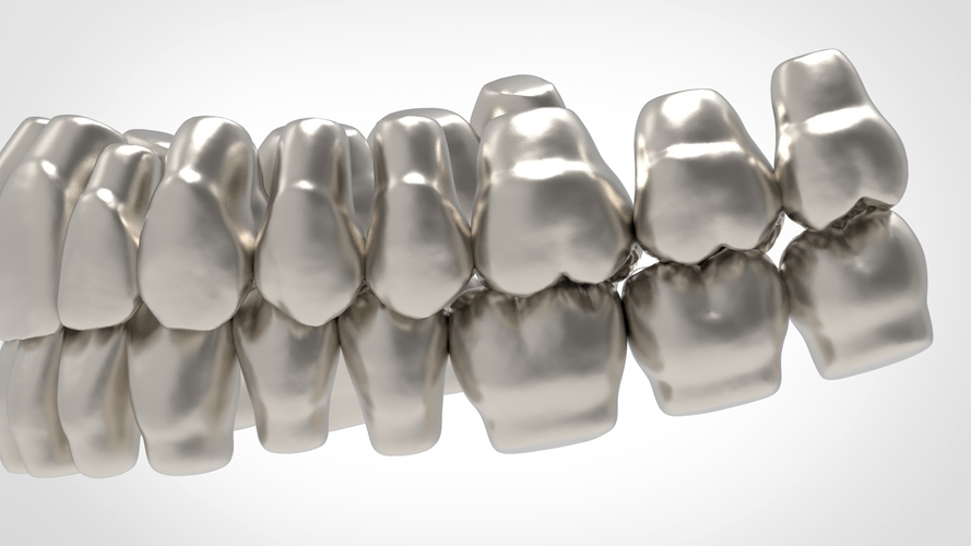Dental Anatomy Library with Thimble Crowns - Azure  3D Print 241190