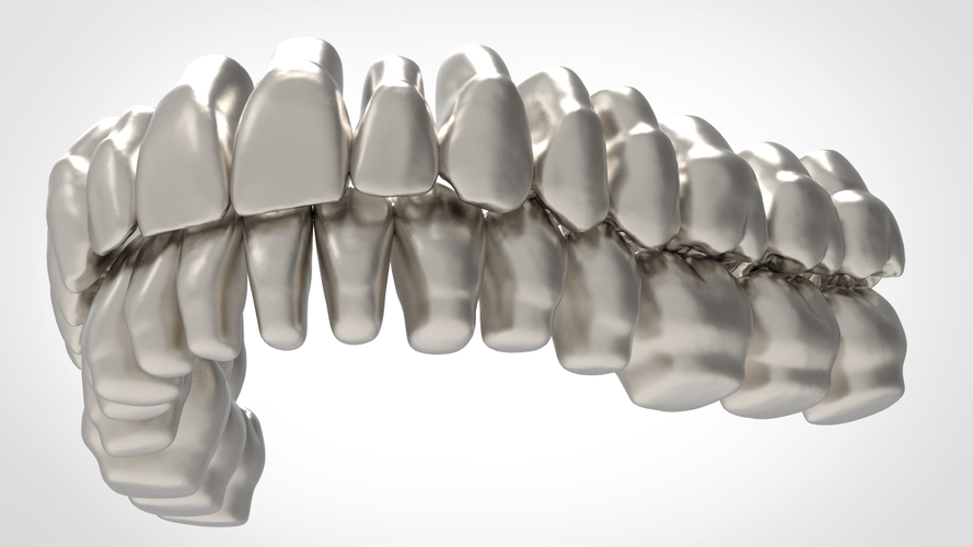 Dental Anatomy Library with Thimble Crowns - Azure  3D Print 241191
