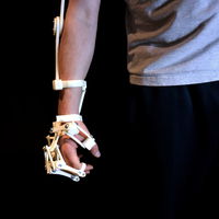 3D Printed Exoskeleton Arms - Thumbnail 3