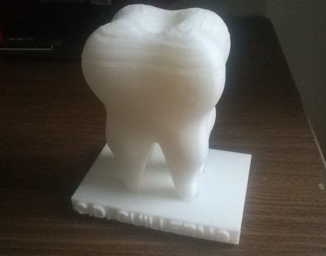 Human Tooth 3D Print 29253