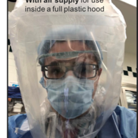 OxyFrame Ventilated Face Mask Frame - Thumbnail 6