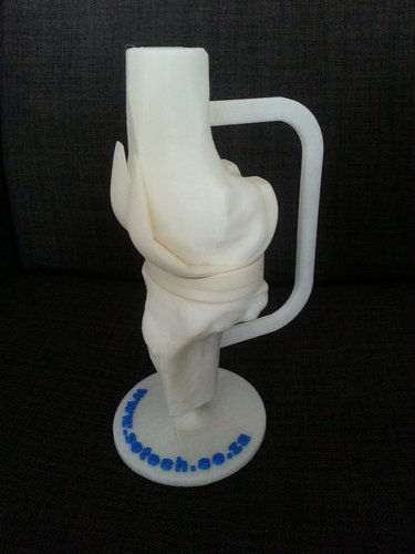 Artificial Knee Prosthesis 3D Print 32843