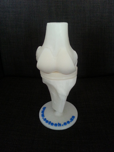 Artificial Knee Prosthesis 3D Print 32844