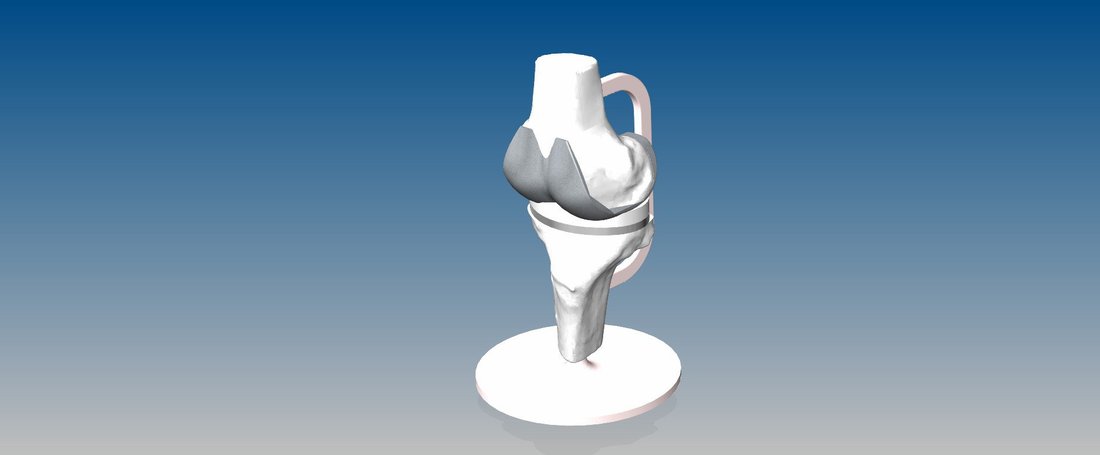 Artificial Knee Prosthesis 3D Print 32845