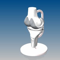 Artificial Knee Prosthesis - Thumbnail 3