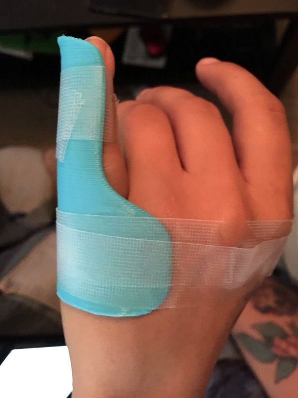 Pinky Splint