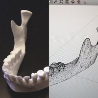 Small Jaw 3D Printing 36041