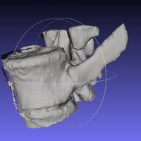 Small Vertebrae (MRI) 3D Printing 38034