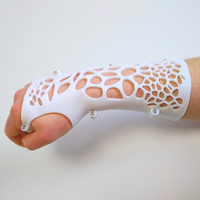 ARM SPLINT - ARM CAST - ARM PLASTER - MEDICAL - Thumbnail 1