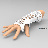Small ARM SPLINT - ARM CAST - ARM PLASTER - MEDICAL 3D Printing 395079