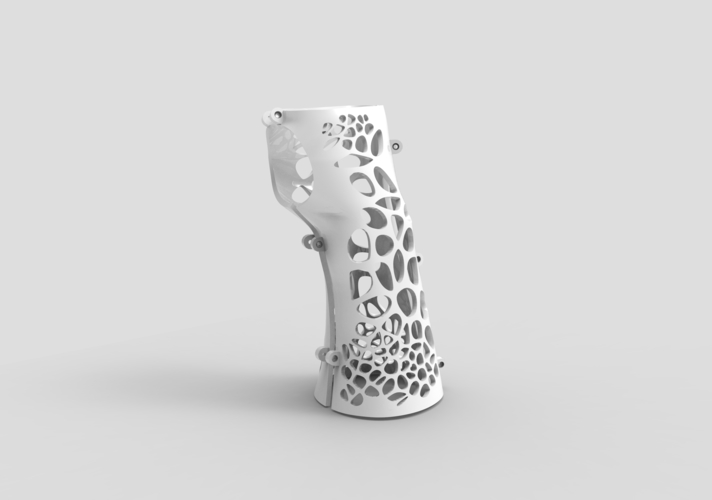 ARM SPLINT - ARM CAST - ARM PLASTER - MEDICAL 3D Print 395521