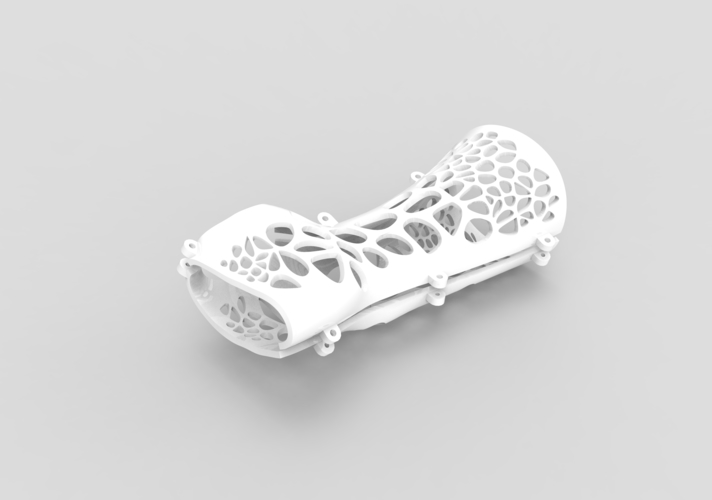 ARM SPLINT - ARM CAST - ARM PLASTER - MEDICAL 3D Print 395524