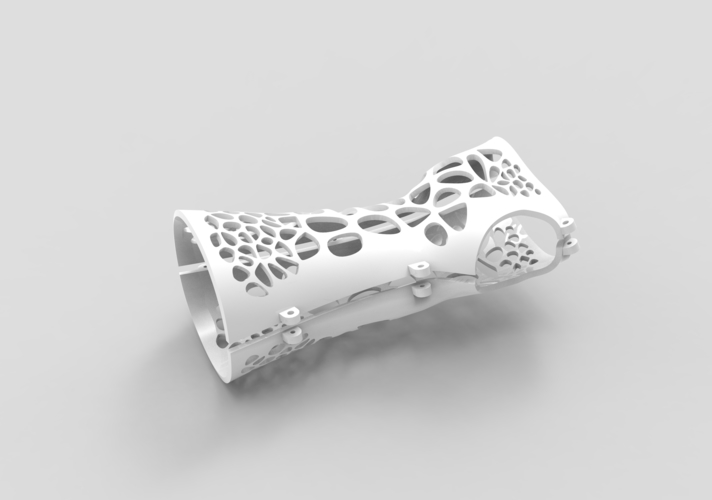 ARM SPLINT - ARM CAST - ARM PLASTER - MEDICAL 3D Print 395525