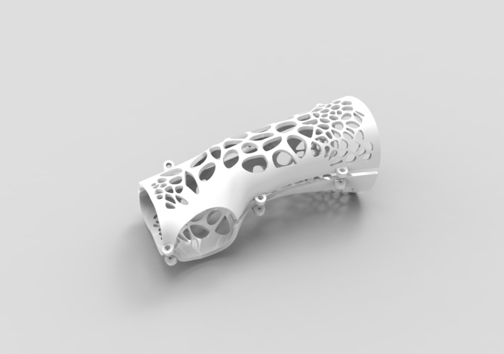 ARM SPLINT - ARM CAST - ARM PLASTER - MEDICAL 3D Print 395526