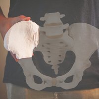 Small Hip Bone Segment (MRI) 3D Printing 44402