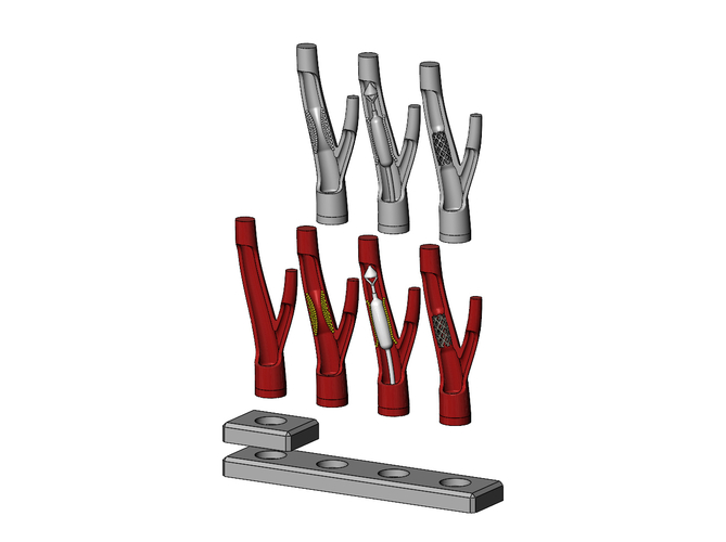 3d printable Carotid artery stenting procedure diorama  3D Print 472812