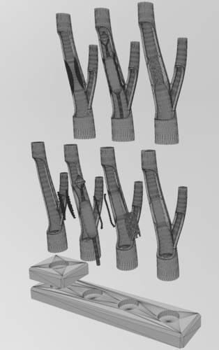 3d printable Carotid artery stenting procedure diorama  3D Print 472818