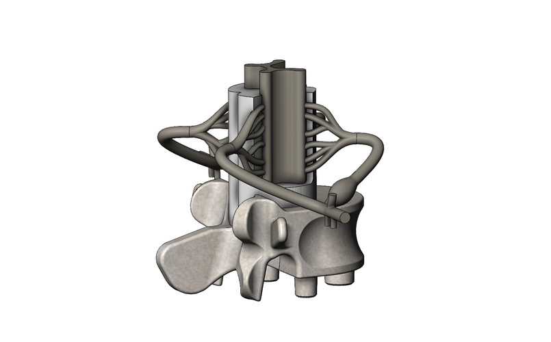 Simplified spinal cord cross section 3D print model 3D Print 472821