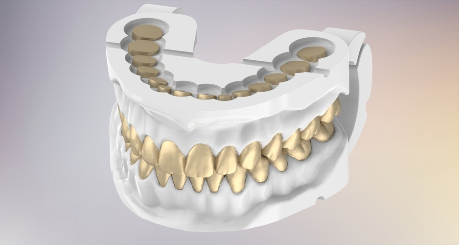 3D Dental Jaws Replica with Detachable Teeth 3D Print 526968