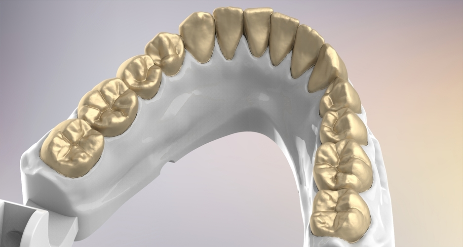 3D Dental Jaws Replica with Detachable Teeth 3D Print 526975