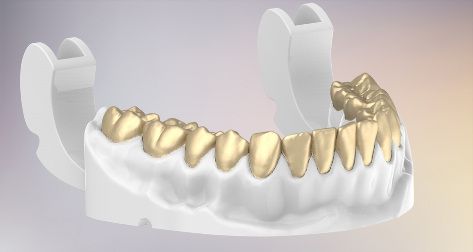 3D Dental Jaws Replica with Detachable Teeth 3D Print 526976