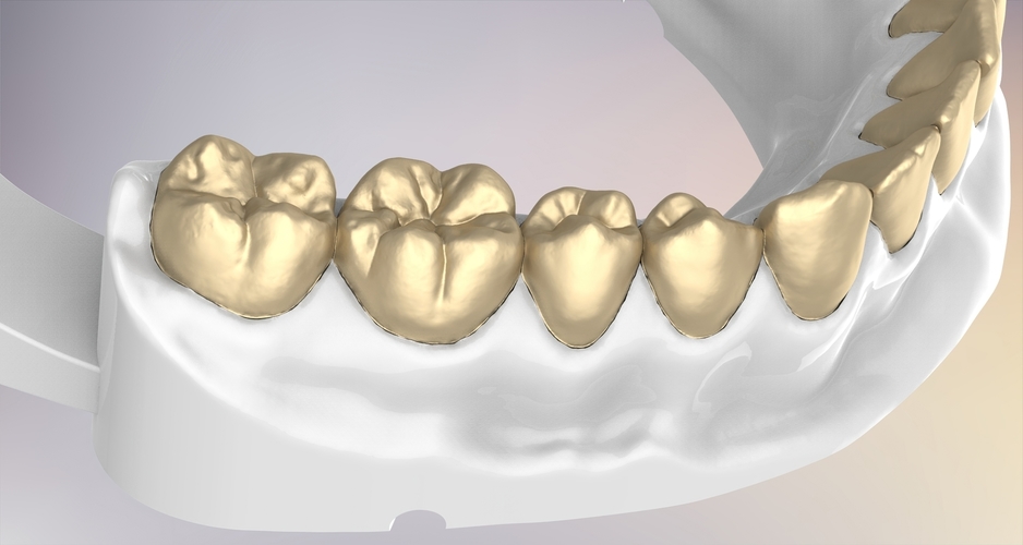 3D Dental Jaws Replica with Detachable Teeth 3D Print 526977