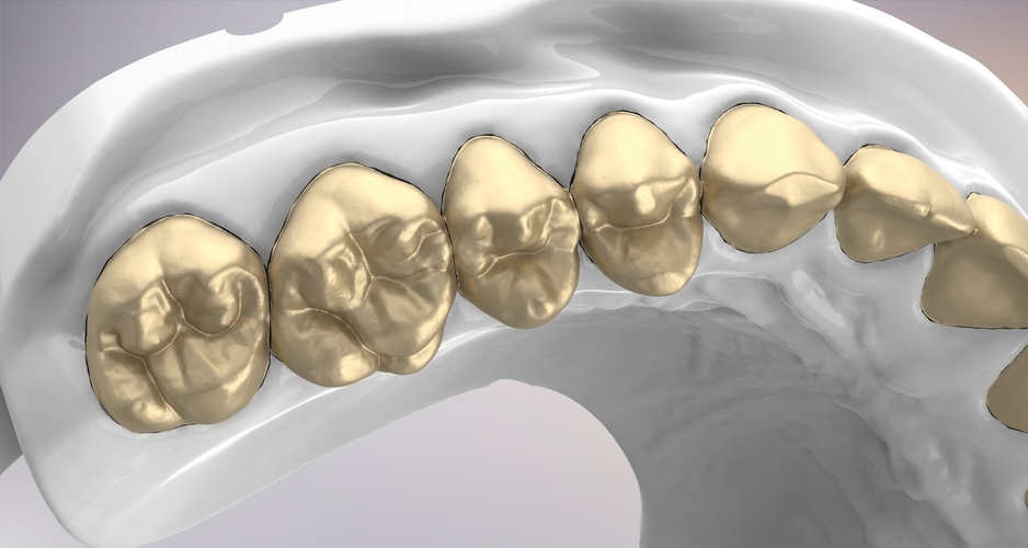 3D Dental Jaws Replica with Detachable Teeth 3D Print 526978