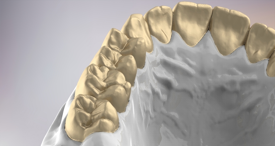 3D Dental Jaws Replica with Detachable Teeth 3D Print 526979