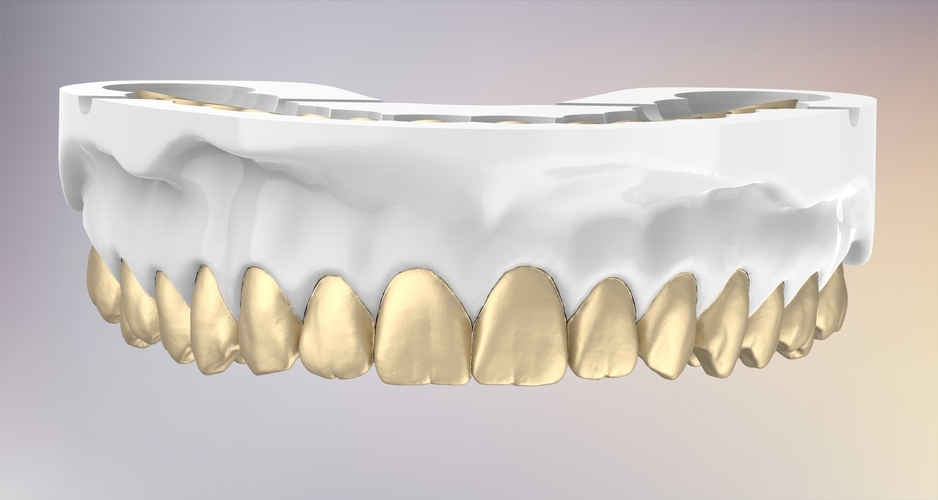 3D Dental Jaws Replica with Detachable Teeth 3D Print 526980