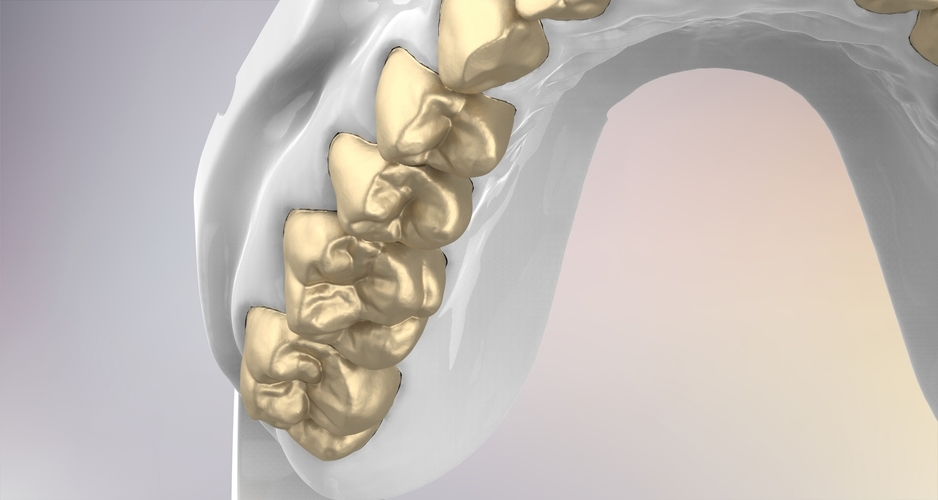 3D Dental Jaws Replica with Detachable Teeth 3D Print 526981