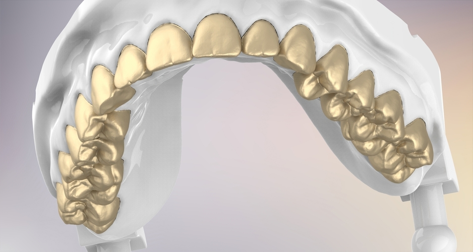 3D Dental Jaws Replica with Detachable Teeth 3D Print 526982