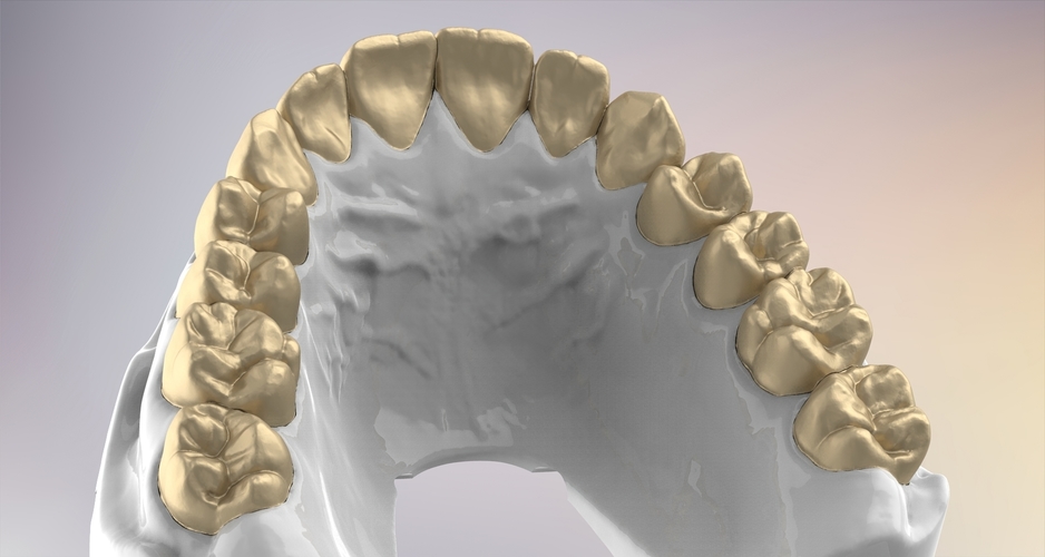 3D Dental Jaws Replica with Detachable Teeth 3D Print 526983