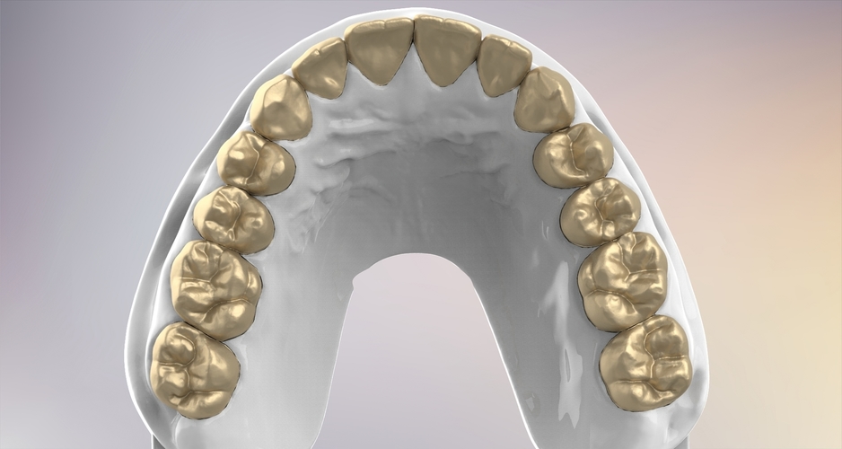 3D Dental Jaws Replica with Detachable Teeth 3D Print 526984