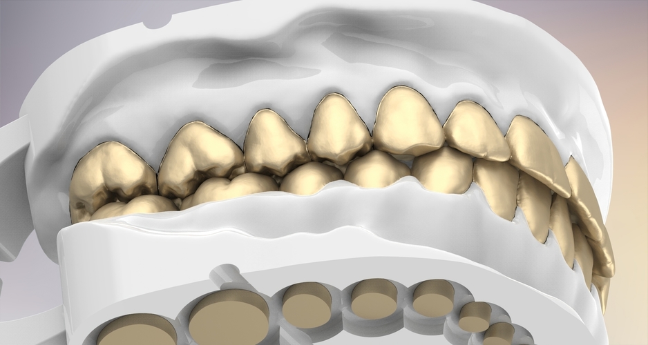 3D Dental Jaws Replica with Detachable Teeth 3D Print 526985