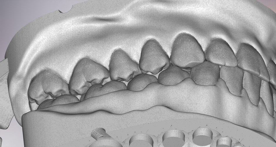 3D Dental Jaws Replica with Detachable Teeth 3D Print 526987