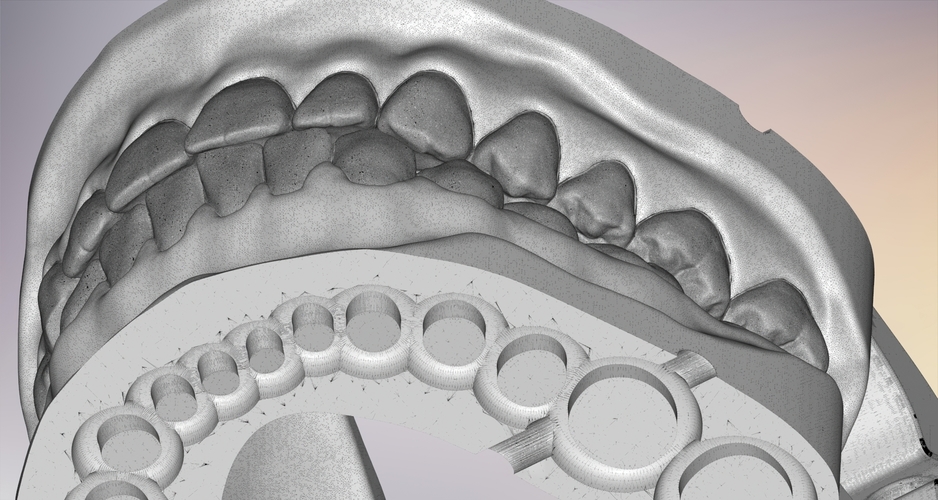 3D Dental Jaws Replica with Detachable Teeth 3D Print 526989