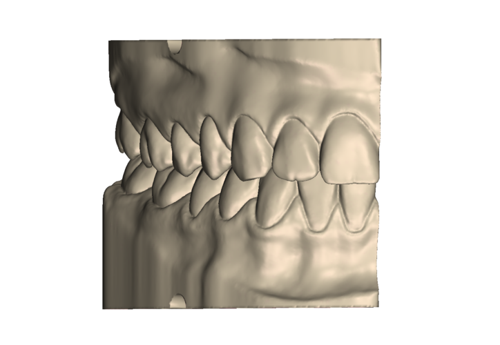 	Dental Practice Model Kit 3D Print 554525