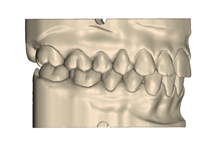 	Dental Practice Model Kit 3D Print 554526