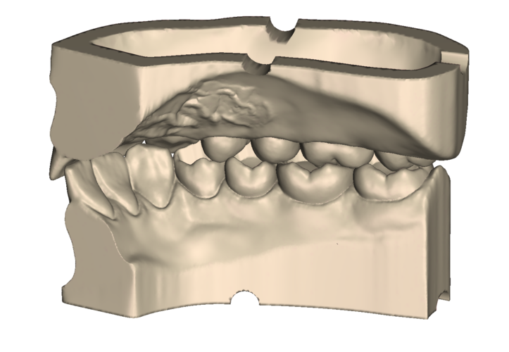 	Dental Practice Model Kit 3D Print 554527